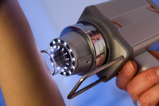 Hautkrebs-Screening, Untersuchung einer Hautstelle am Arm mit einem Auflichtmikroskop